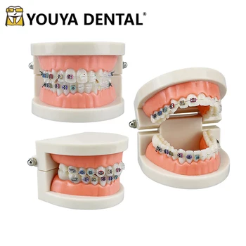 Ортодонтическая модель для практики зубов Для обучения Модели общения врача и пациента